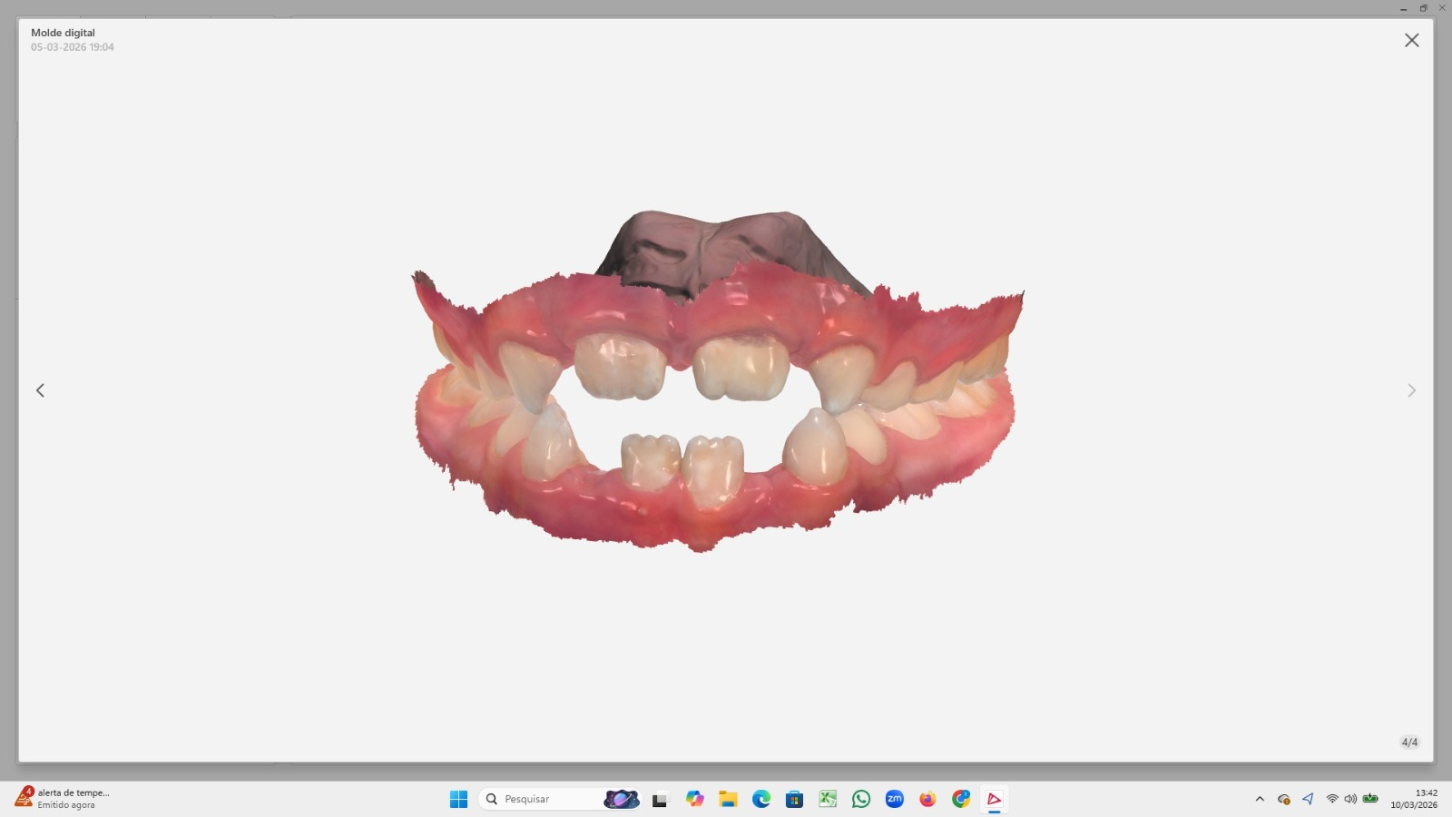 Escaneamento Intraoral 3D